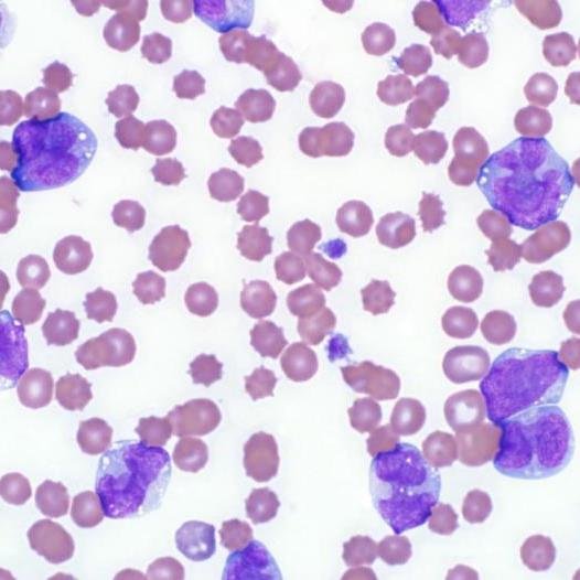 Feline leukemia virus (FeLV)